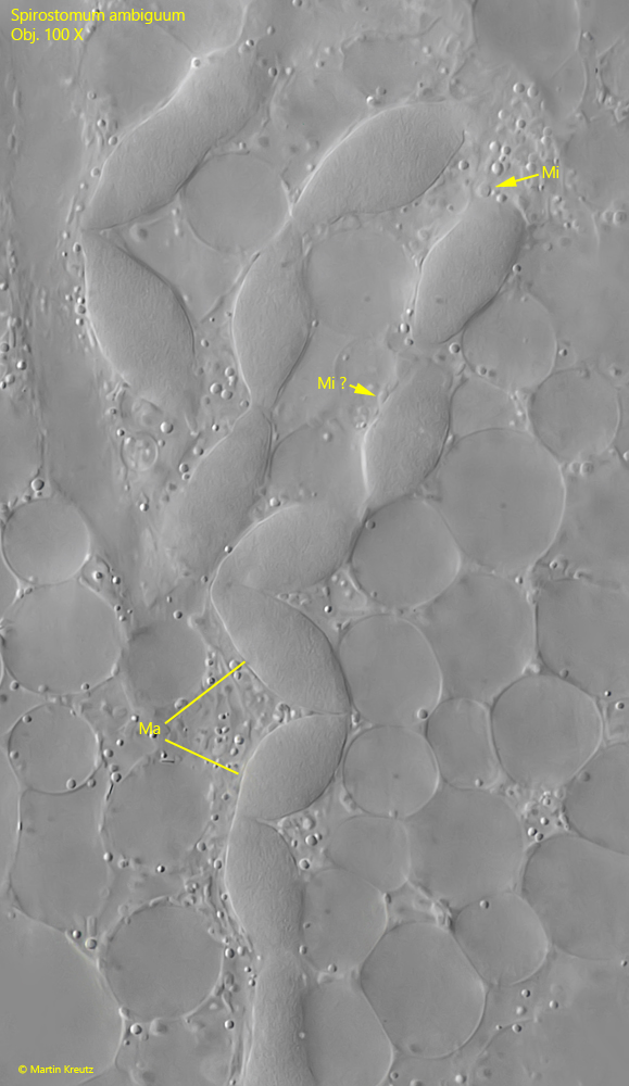 Spirostomum-ambiguum