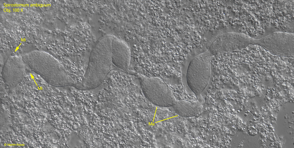 Spirostomum-ambiguum