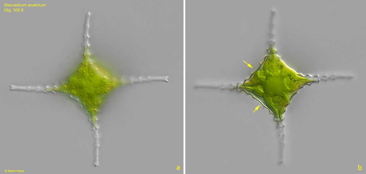 Staurastrum-anatinum