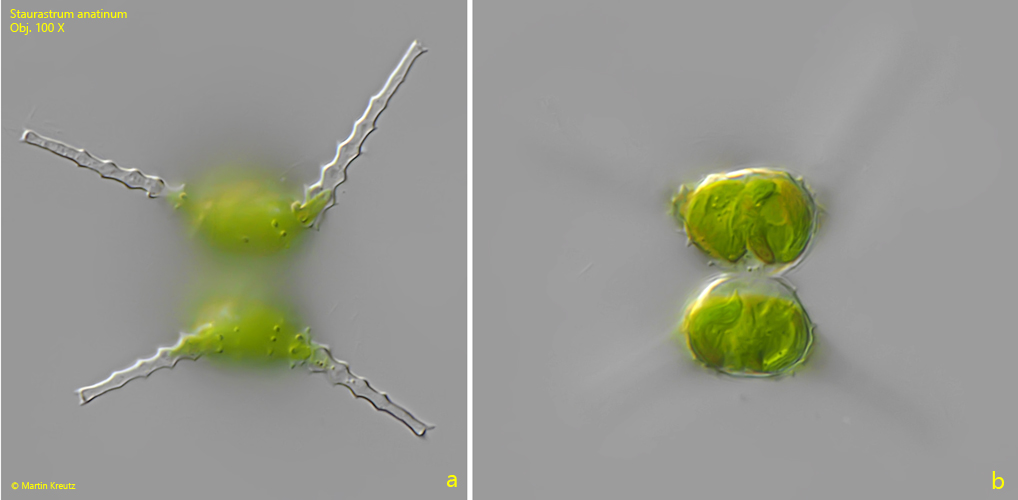 Staurastrum-anatinum