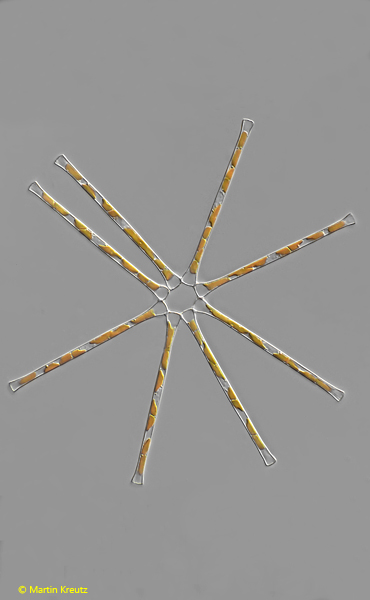 Asterionella-formosa