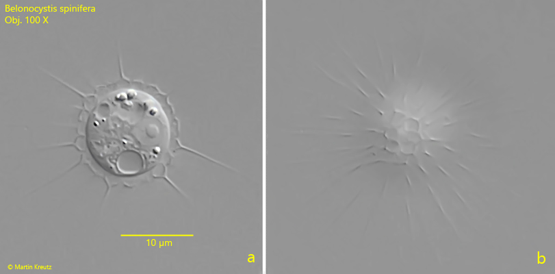 Belonocystis-spinifera