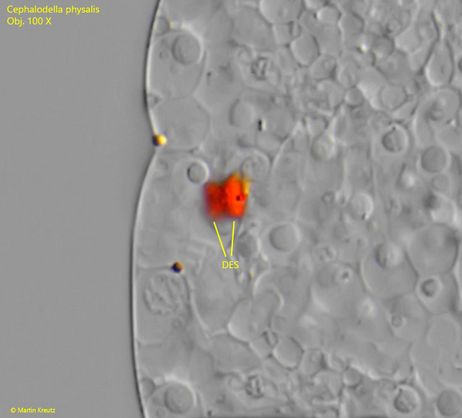 Cephalodella-physalis