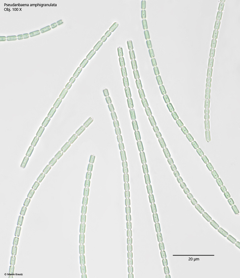 Pseudanabaena-amphigranulata