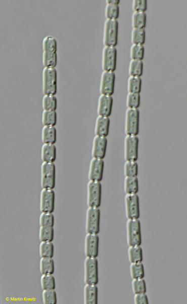 Pseudanabaena-amphigranulata