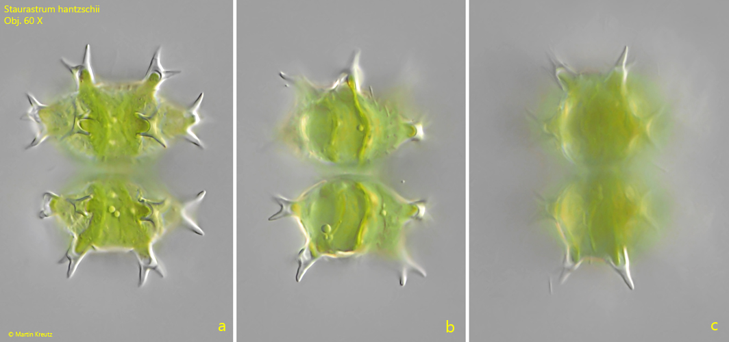 Staurastrum-hantzschii