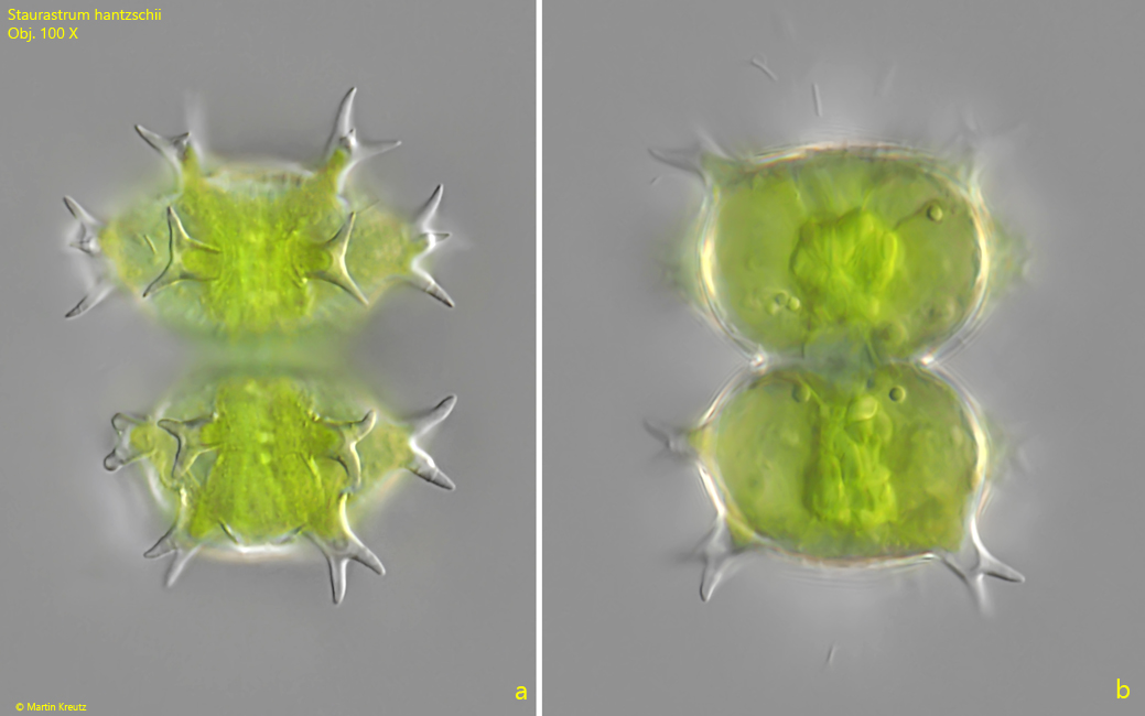 Staurastrum-hantzschii