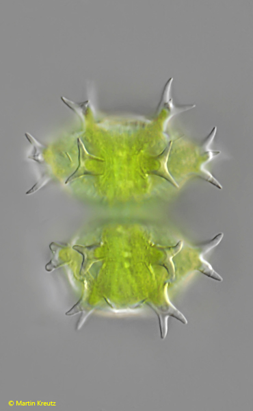 Staurastrum-hantzschii