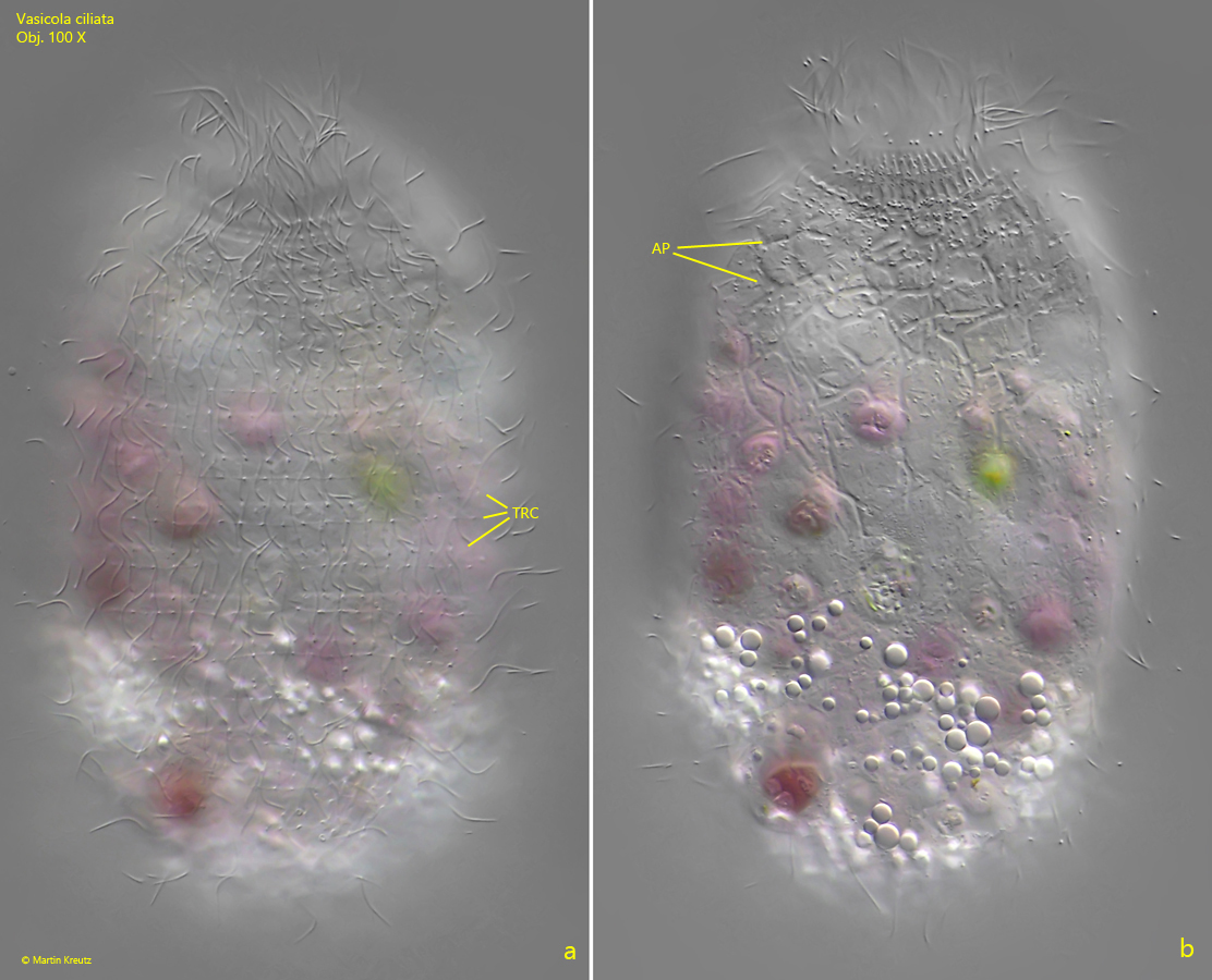 Vasicola-ciliata