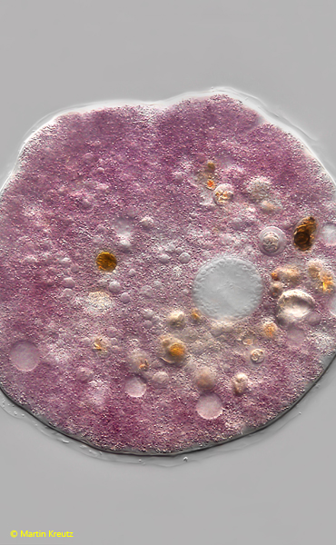 Amphizonella-violacea