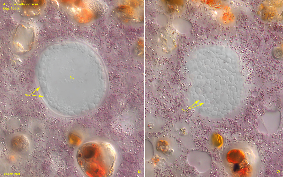 Amphizonella-violacea