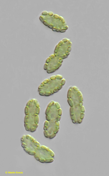 Chlorochromatium-aggregatum