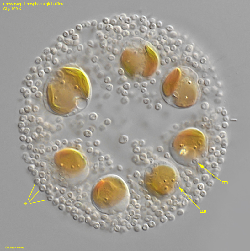 Chrysostephanosphaera-globulifera