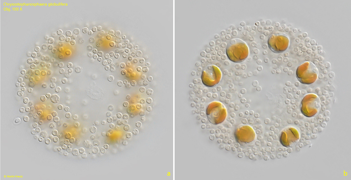 Chrysostephanosphaera-globulifera