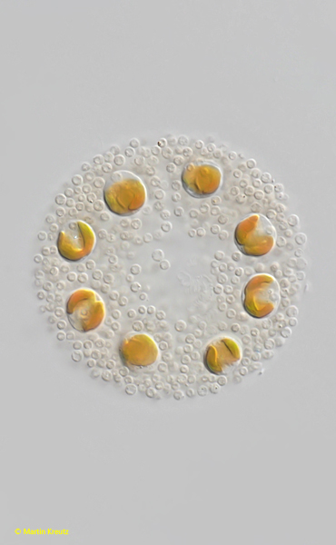 Chrysostephanosphaera-globulifera