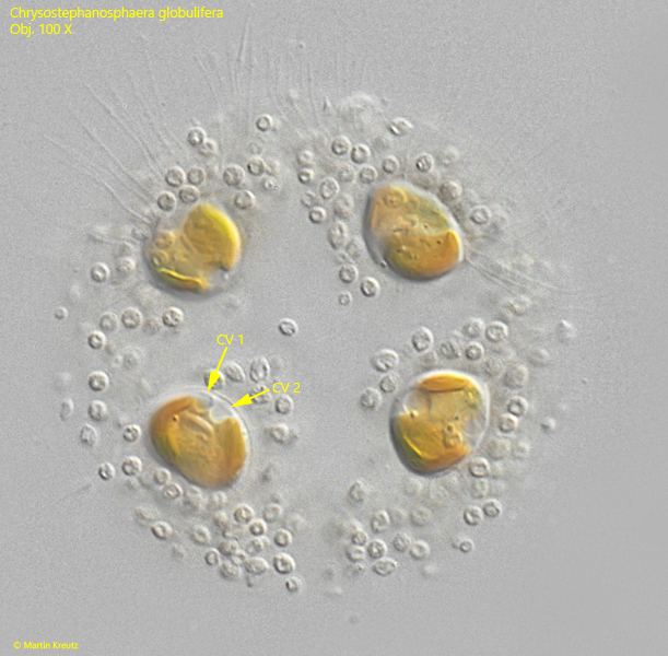 Chrysostephanosphaera-globulifera
