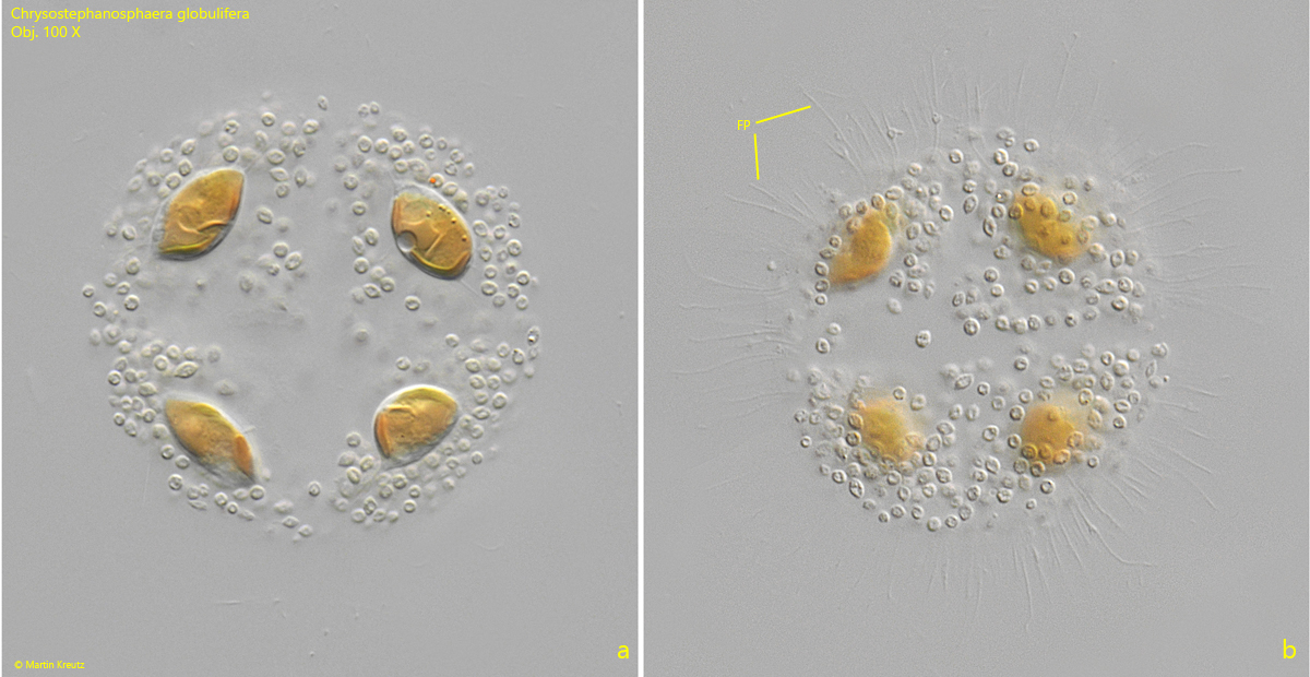 Chrysostephanosphaera-globulifera