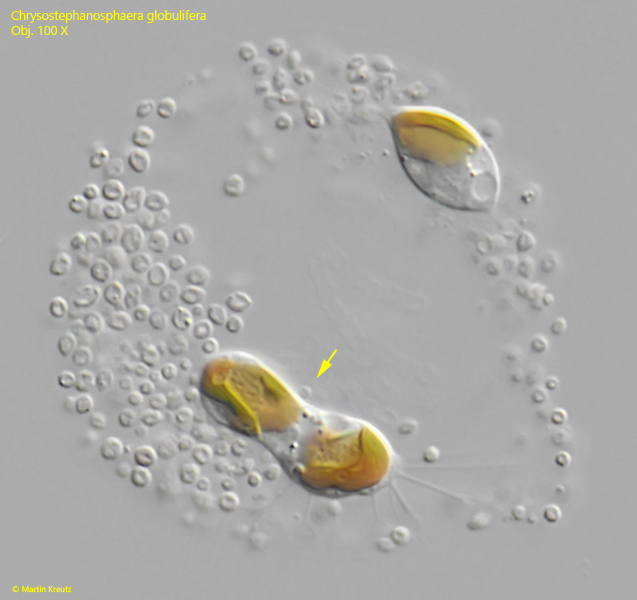 Chrysostephanosphaera-globulifera
