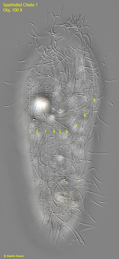 Spathidiid ciliate 1