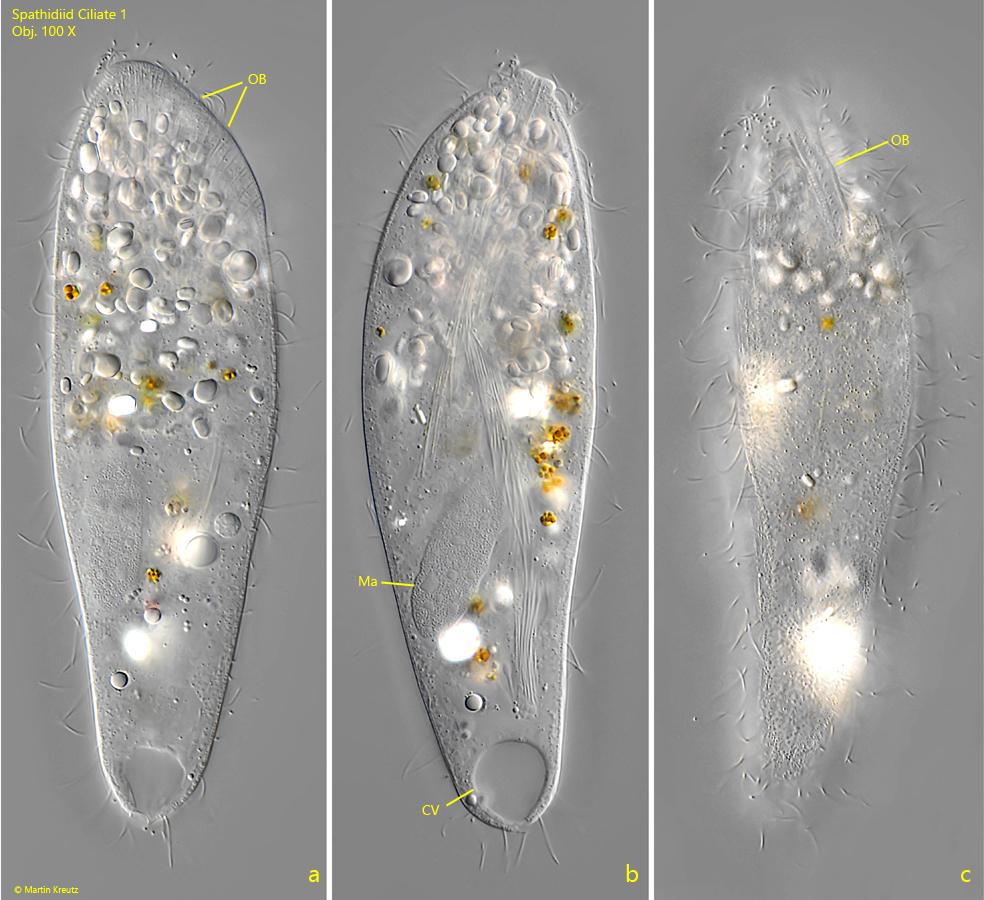 Spathidiid ciliate 1