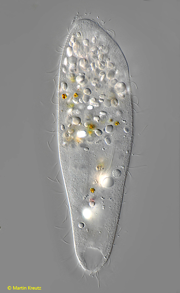 Spathidiid ciliate 1