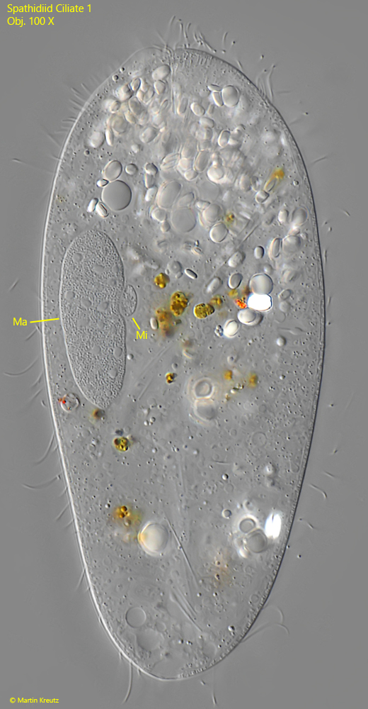 Spathidiid ciliate 1