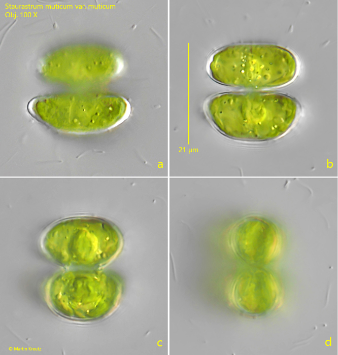 Staurastrum-muticum-var-muticum