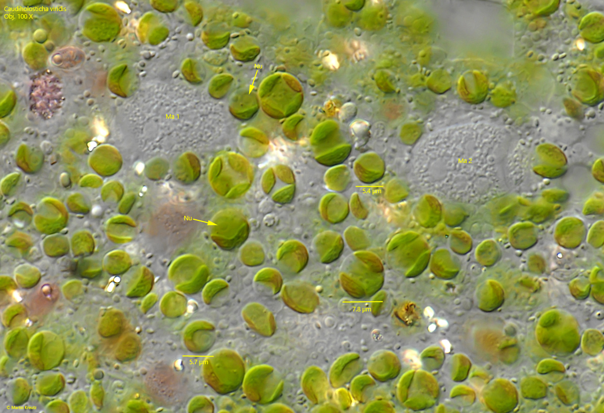 Caudiholosticha-viridis