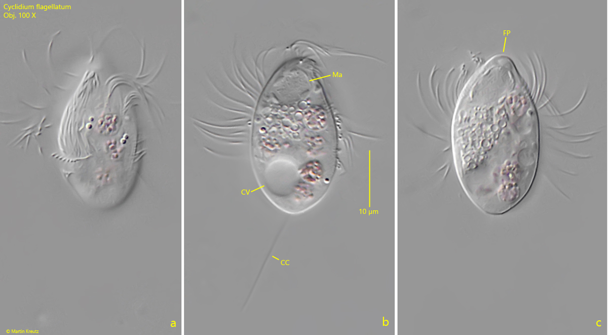 Cyclidium-flagellatum