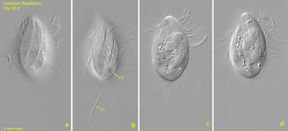 Cyclidium-flagellatum