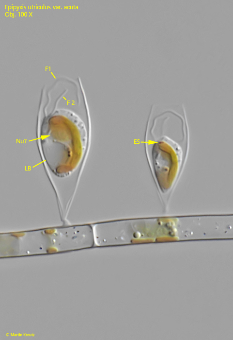 Epipyxis-utriculus-var-acuta