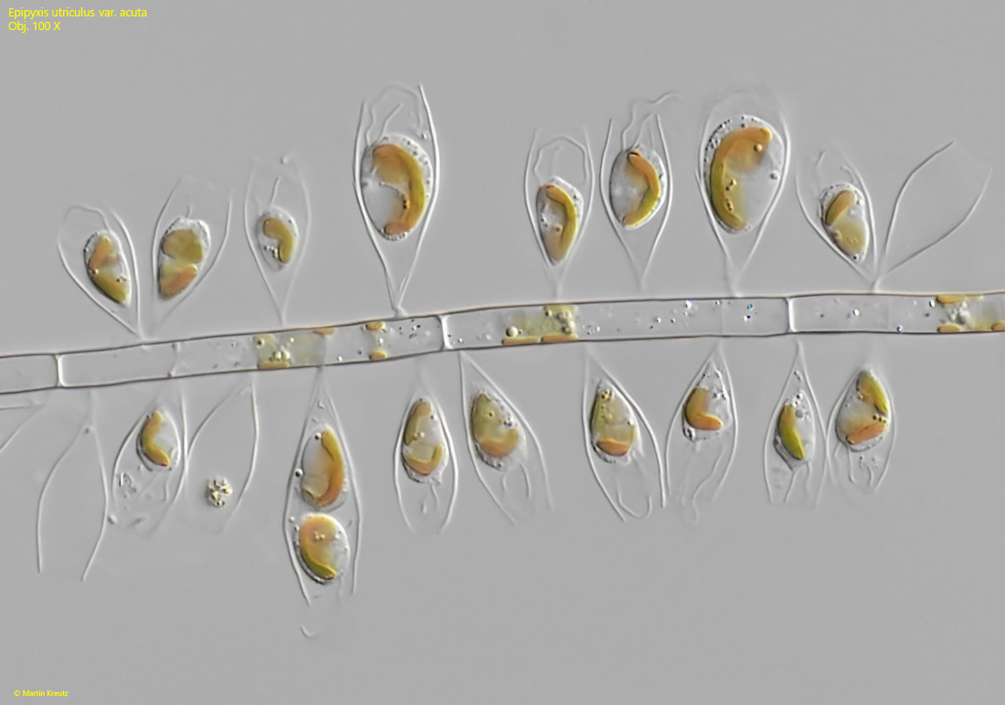 Epipyxis-utriculus-var-acuta