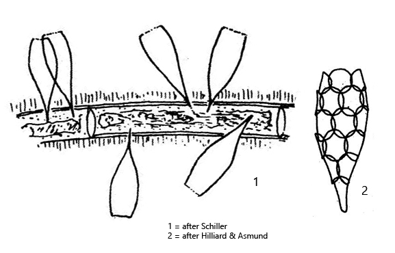 Epipyxis-utriculus-var-acuta