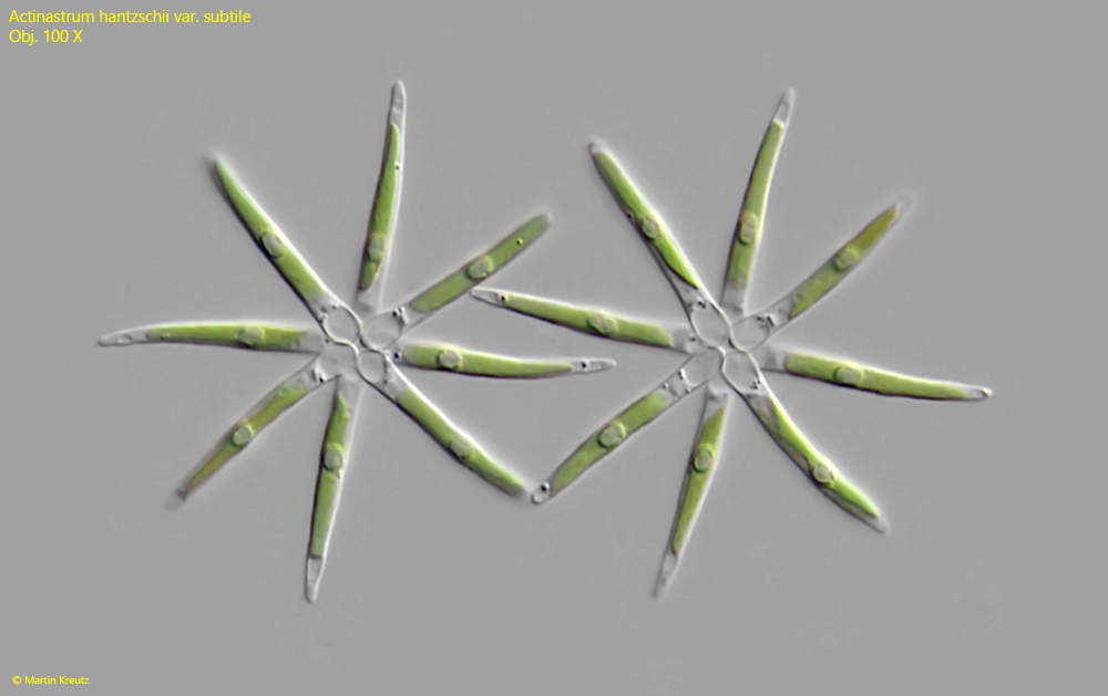 Actinastrum-hantzschii-var-subtile