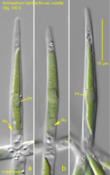 Actinastrum-hantzschii-var-subtile