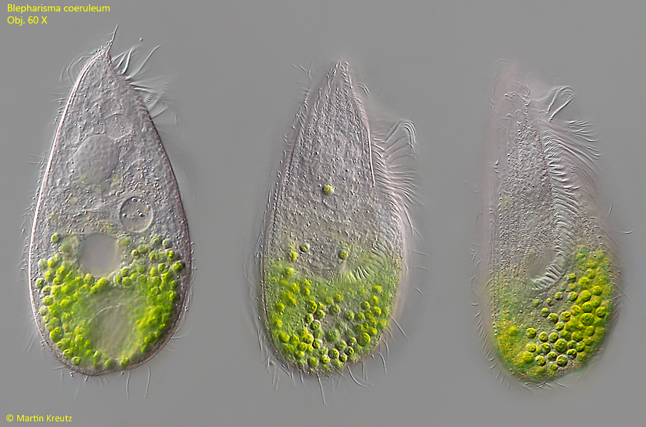 Blepharisma-coeruleum
