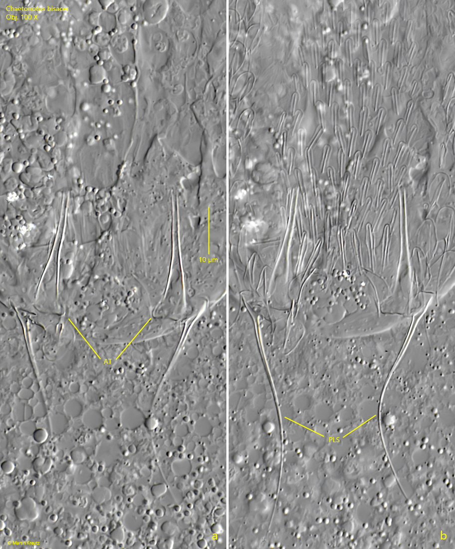 Chaetonotus-bisacer