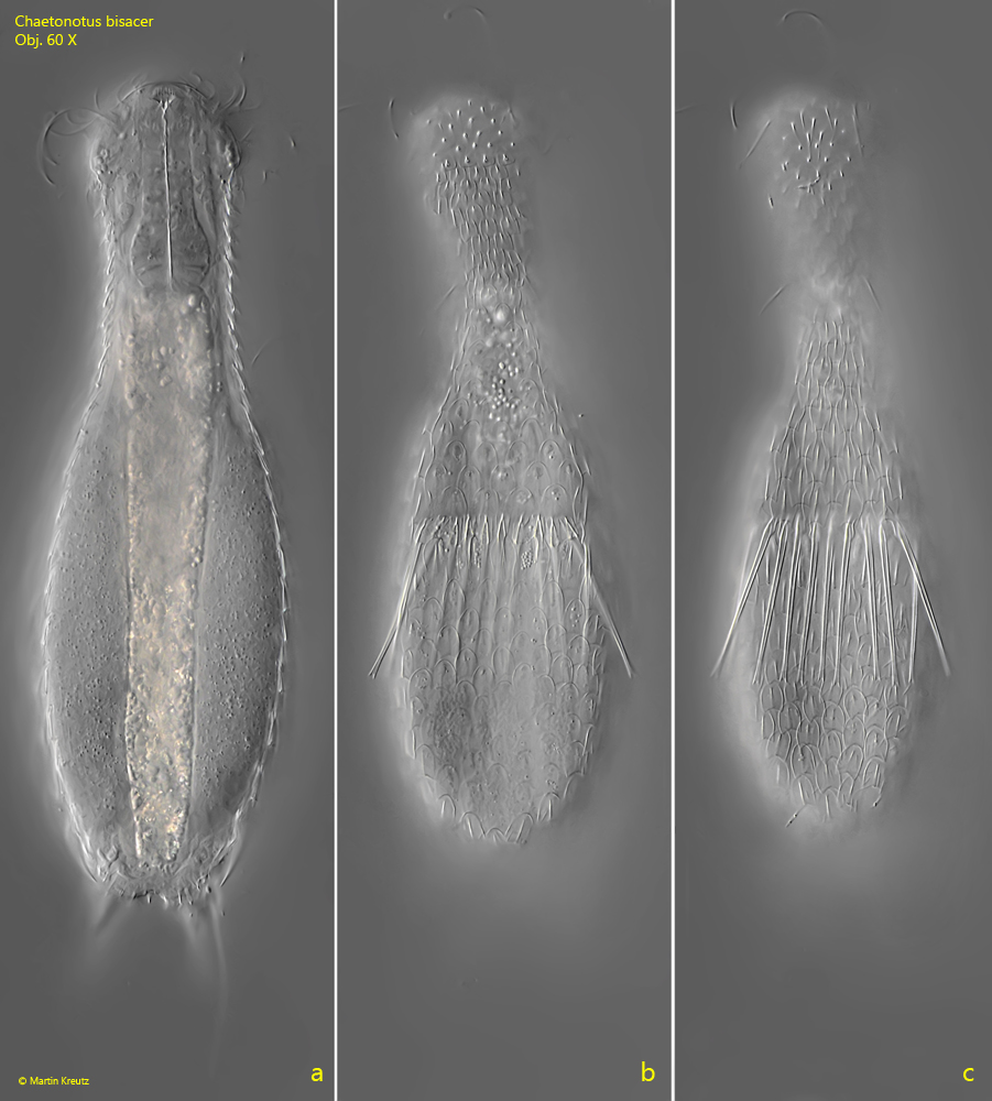 Chaetonotus-bisacer