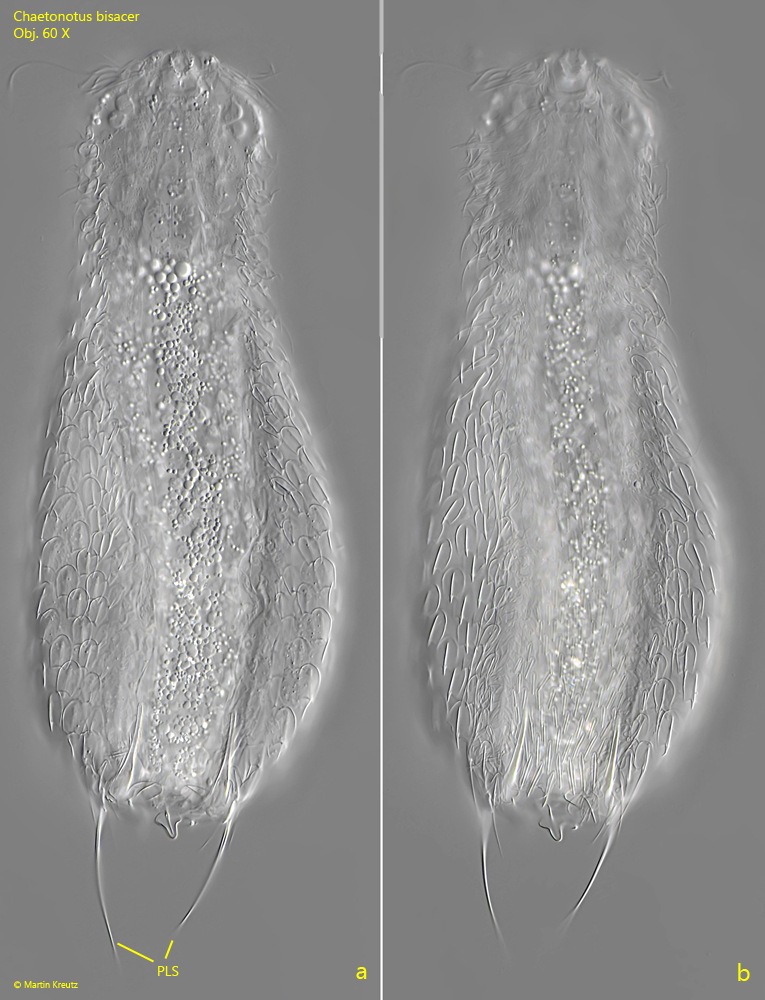 Chaetonotus-bisacer