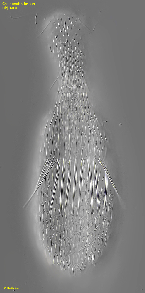 Chaetonotus-bisacer