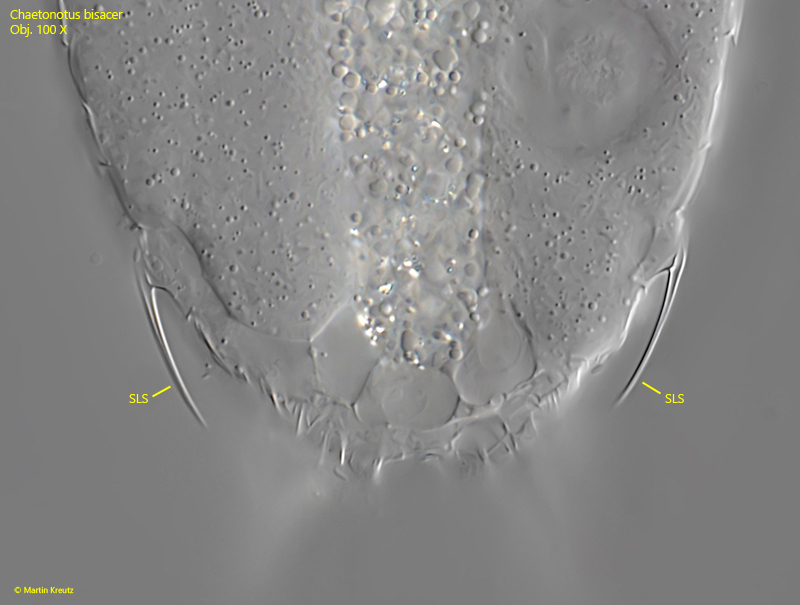 Chaetonotus-bisacer