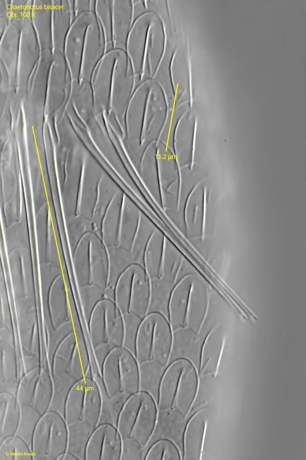 Chaetonotus-bisacer
