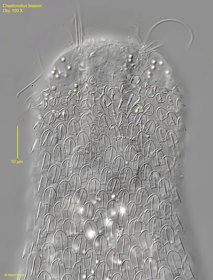 Chaetonotus-bisacer