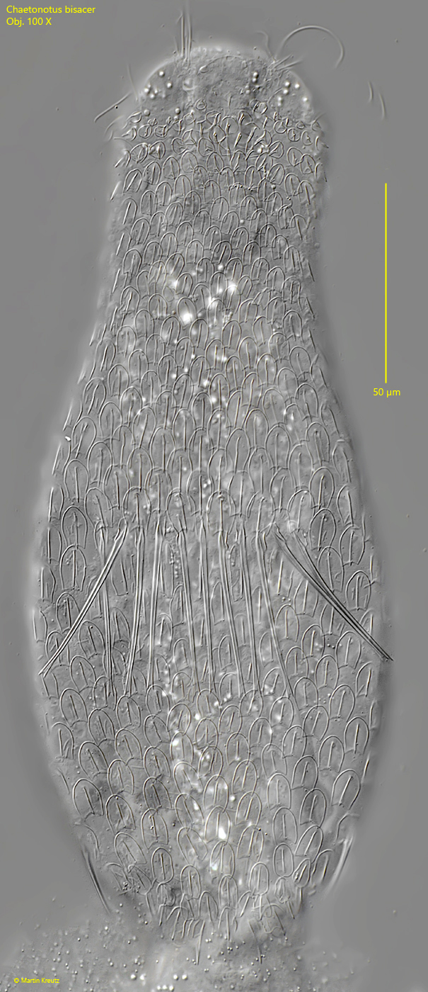 Chaetonotus-bisacer