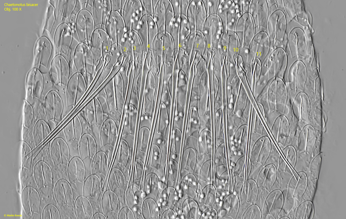 Chaetonotus-bisacer