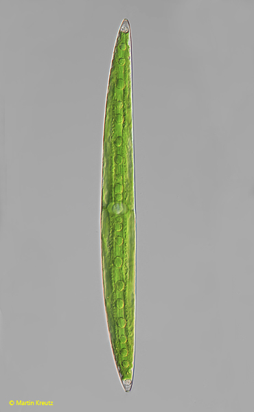 Closterium-pritchardianum