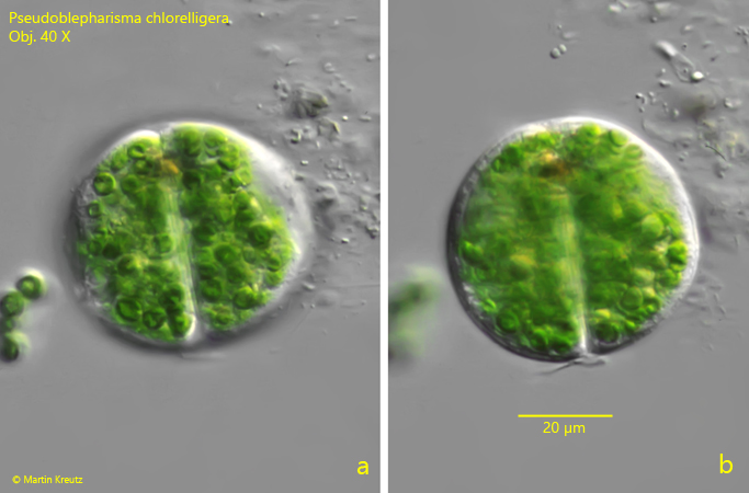 Pseudoblepharisma-chlorelligera