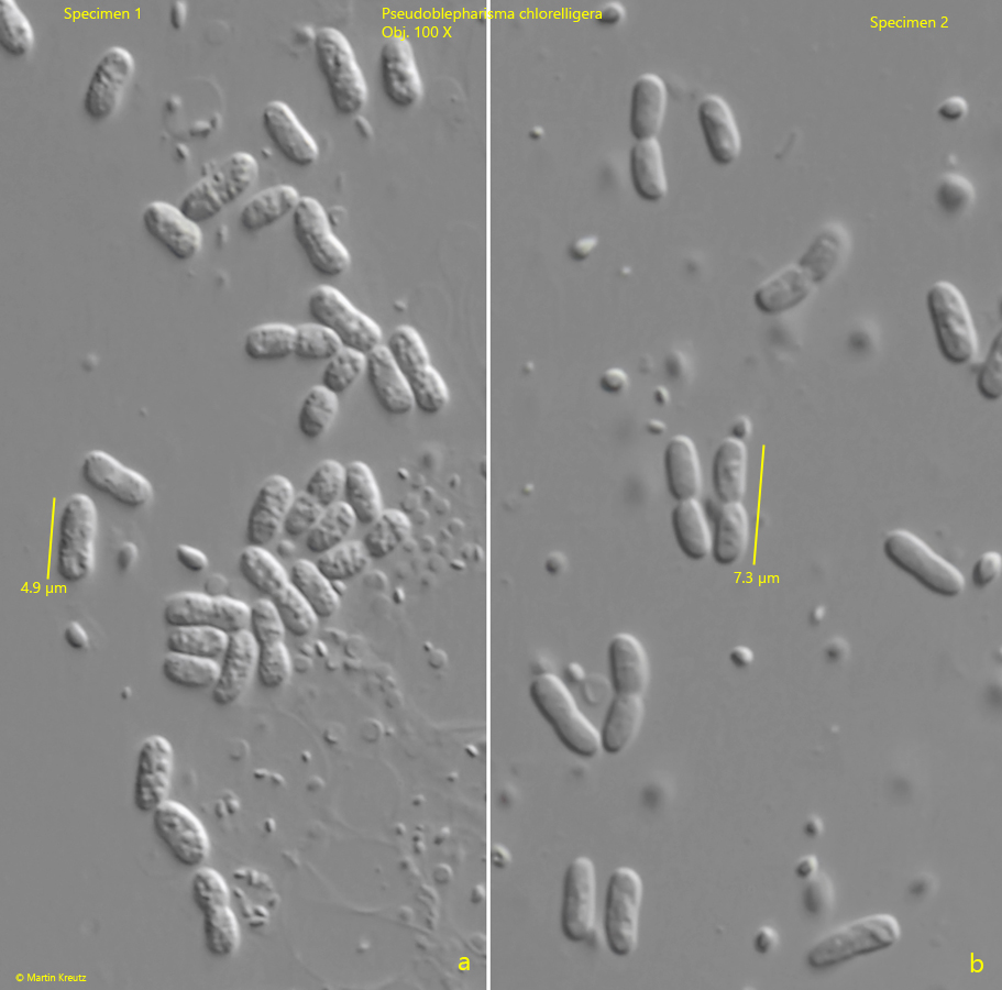 Pseudoblepharisma-chlorelligera