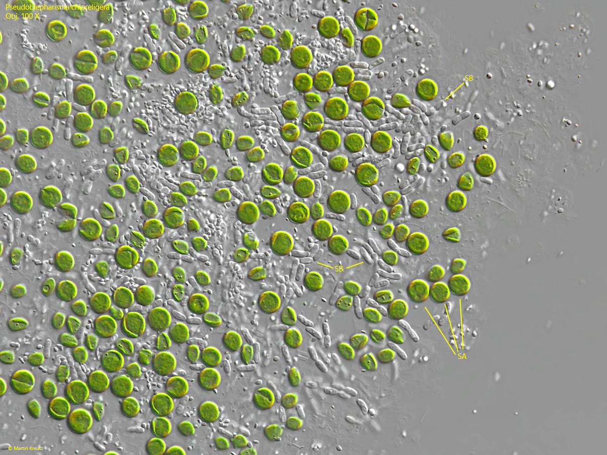 Pseudoblepharisma-chlorelligera
