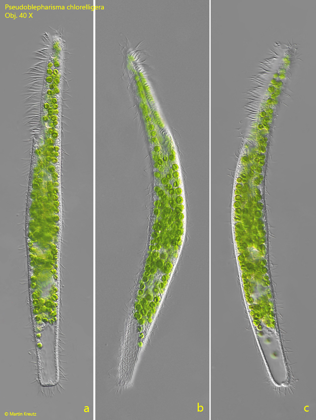 Pseudoblepharisma-chlorelligera